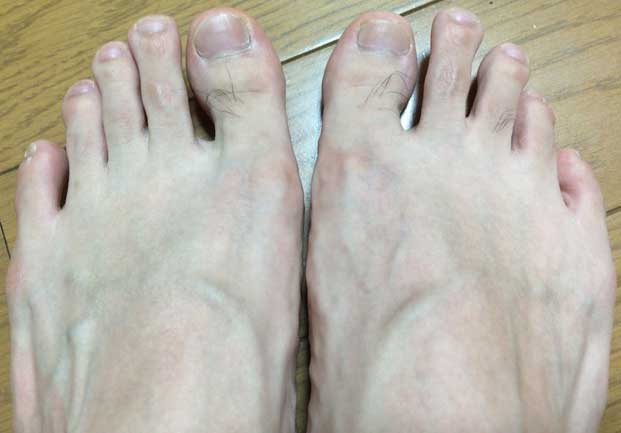 足の爪